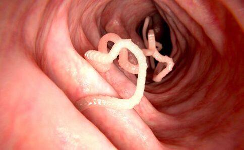 črvi v človeškem telesu