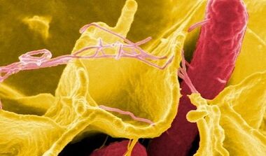 Znaki parazitov v človeškem telesu