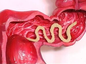 paraziti v človeškem telesu, zakaj se pojavljajo