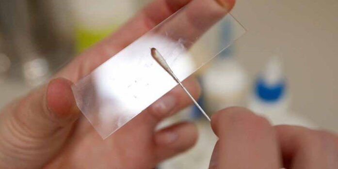 Strganje kože za paraziti