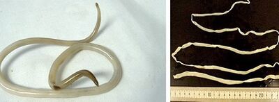 Vrste parazitov v človeškem telesu