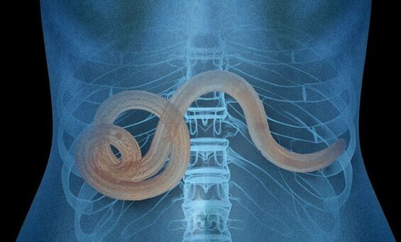 parazit v človeškem telesu