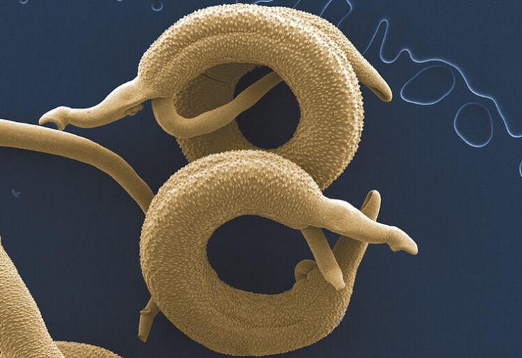 paraziti, ki živijo v človeškem telesu