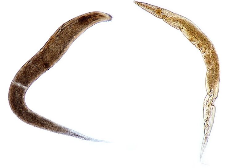 pinworms v telesu otrok